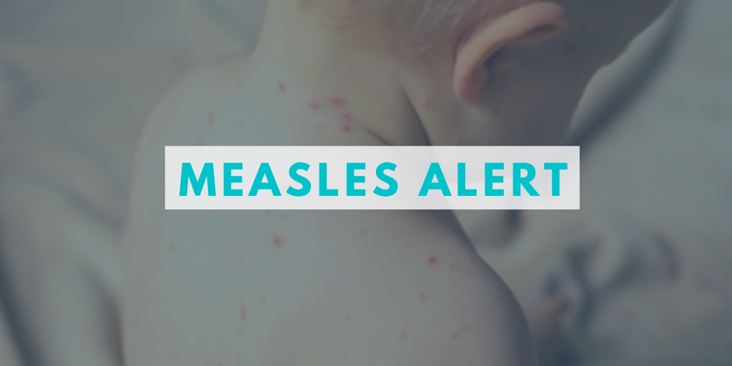 Measles Alert NICD